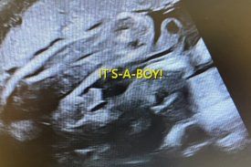 Baby Gender Scan from 16 Weeks | Private Ultrasound | Baby Grows Scan ...